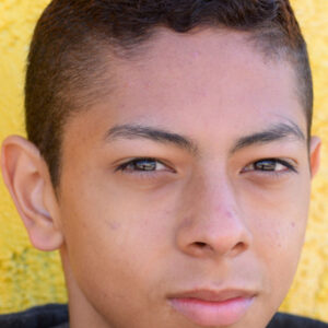 Skin Healing Image Enhancement